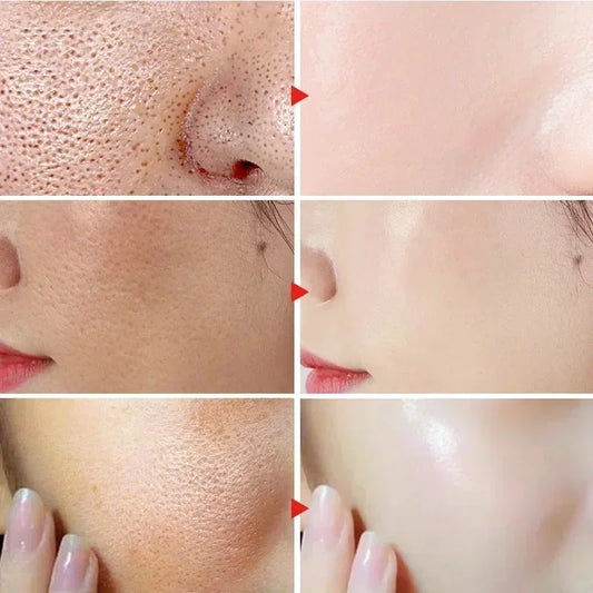 Remove Large Pores Serum Lactic Acid Facial Pore Shrinking Repairing Products