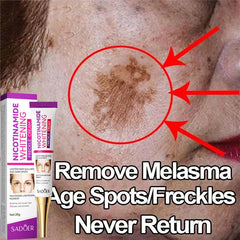 Whitening Freckles Serum Cream to Remove Dark Spots