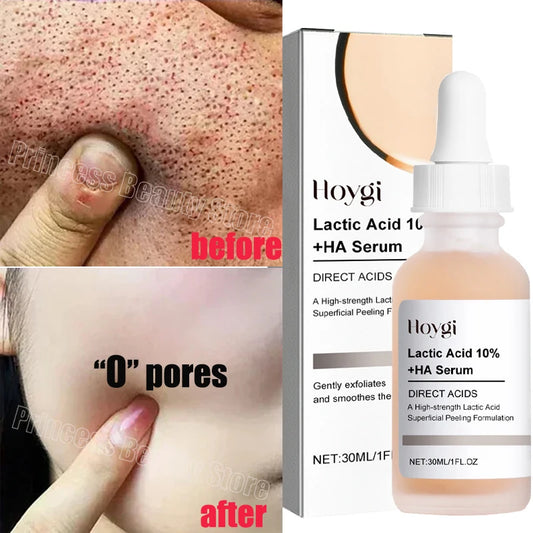 Remove Large Pores Serum Lactic Acid Facial Pore Shrinking Repairing Products