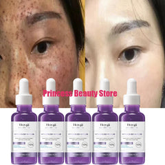 Dark Spots Remover Whitening Serum